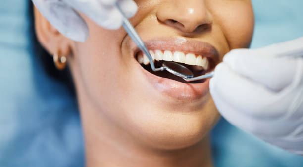 Best Emergency Wisdom Teeth Removal in Morehead City, NC
